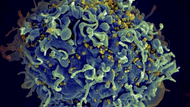 HIV: médicos anunciam 4º caso de cura
