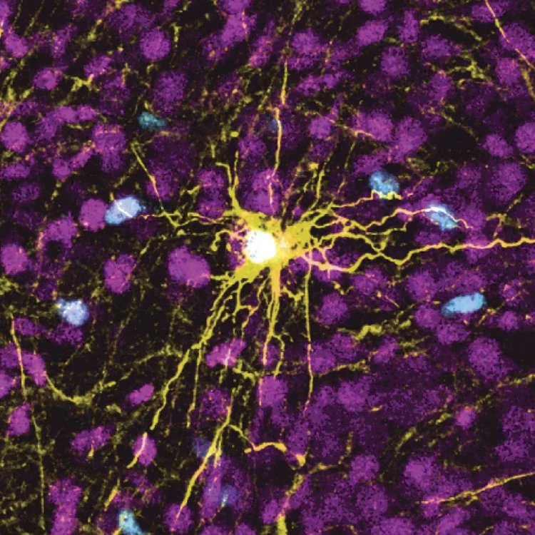 Células cerebrais humanas são implantadas em ratos para estudar doenças mentais