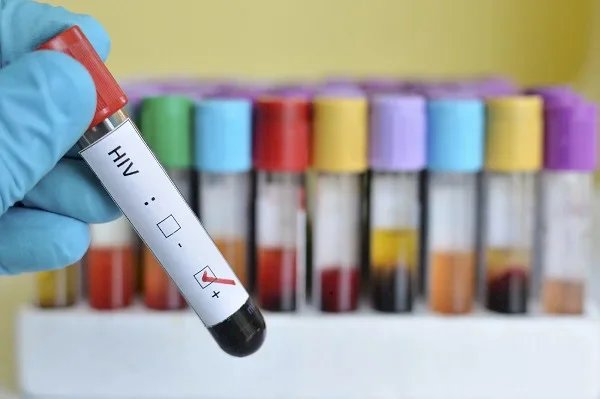 HIV: quais são os tipos de teste e quando é necessário fazer?
