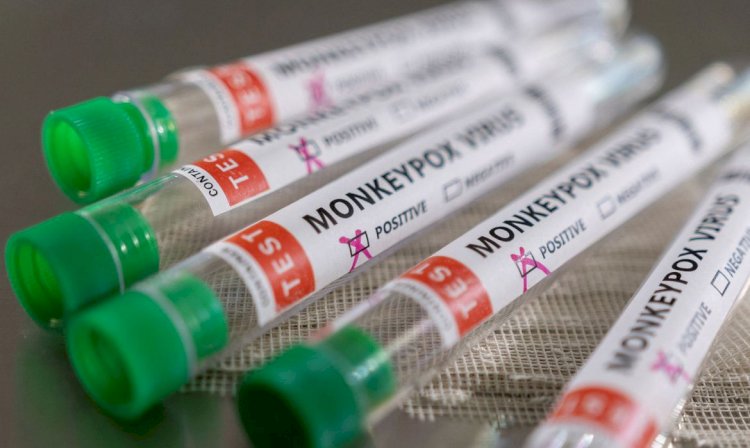 São Paulo inicia vacinação de pessoas com baixa imunidade contra mpox