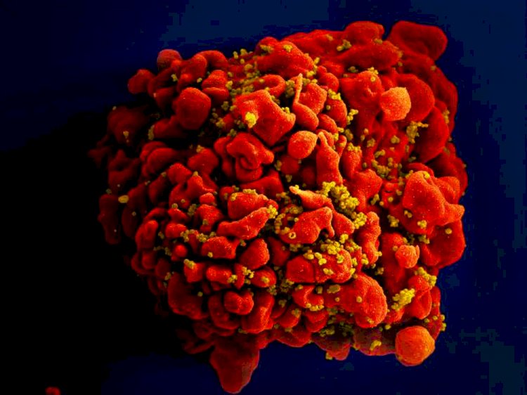 Cientistas anunciam novo caso de remissão do HIV após transplante de medula óssea