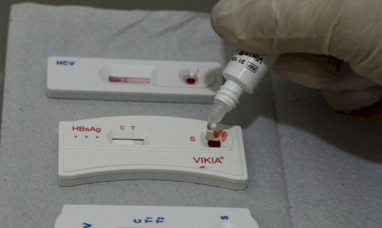 SP tem 30 mil cadastrados para profilaxia pré-exposição ao HIV