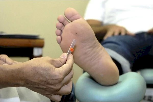 Entenda os perigos do pé diabético e como prevenir as feridas
